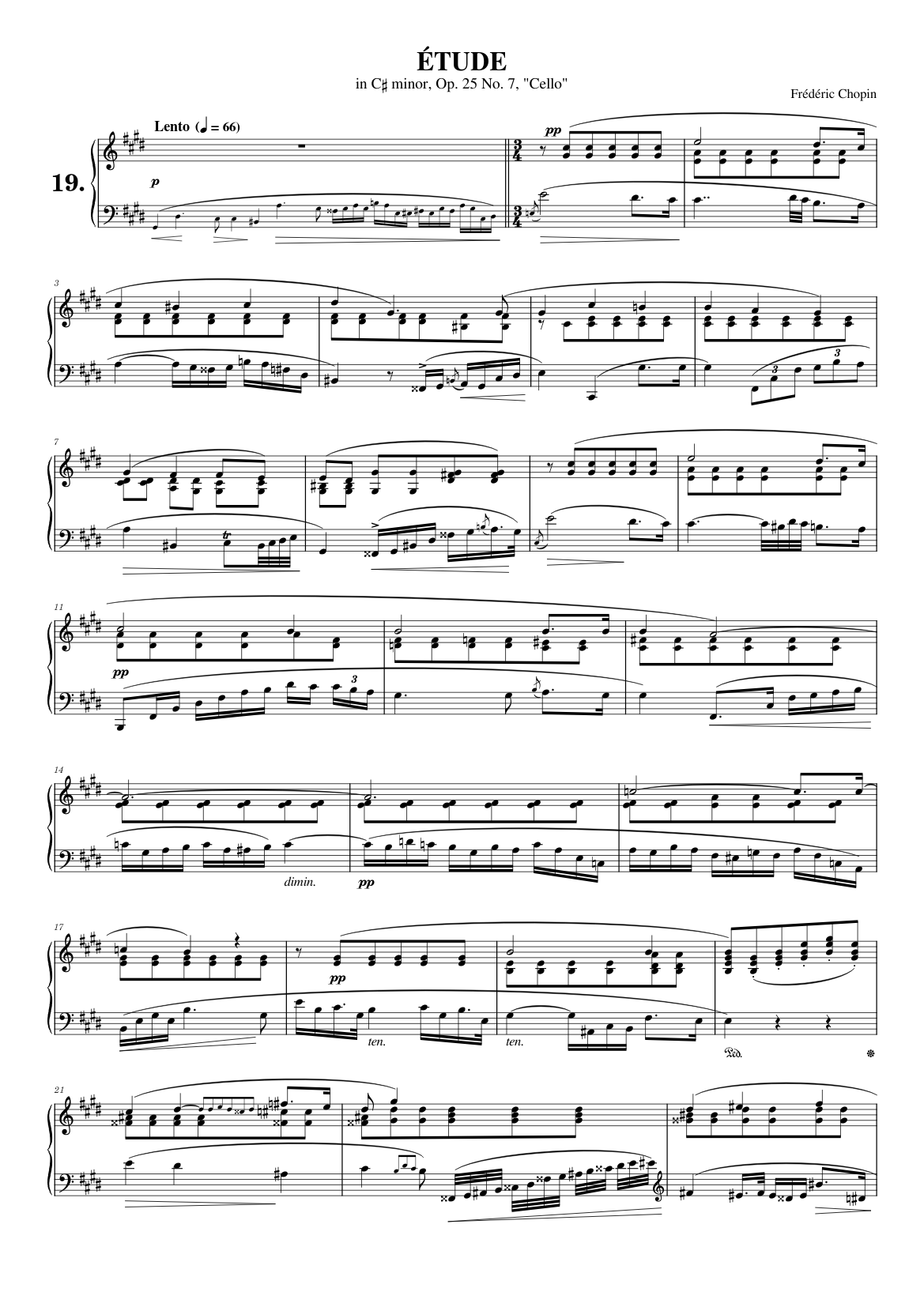 Études Op.25