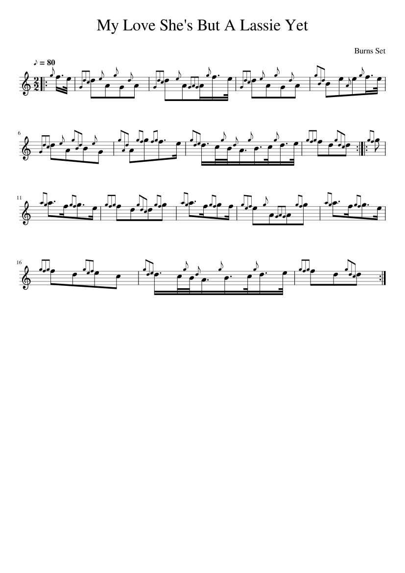 My Love She's But A Lassie Yet